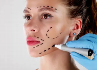 Plastični kirurgi razkrivajo: To so trendi v naslednjih mesecih Facial Aesthetics Facelift. Plastic Surgery Drawings On Face