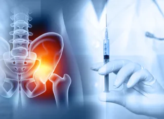 Kaj je burzitis? Od nastanka do zdravljenja in preprečevanje Injection for hip arthritis. Hip joint injections. 3d illustration