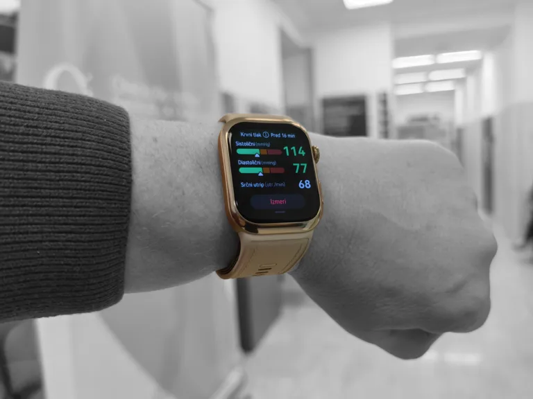 Huawei Watch D2 je najboljša ura v tem segmentu