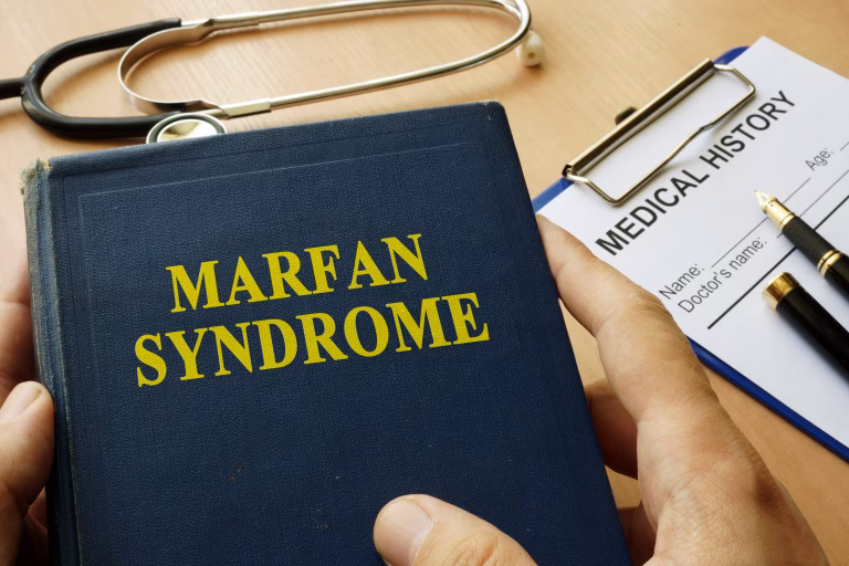 Kaj je Marfanov sindrom?