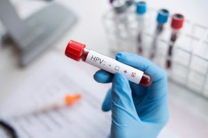 hpv test
