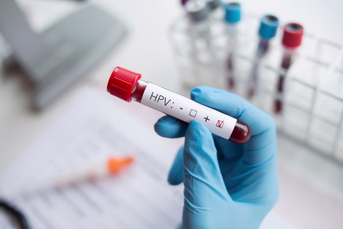 hpv testiranje