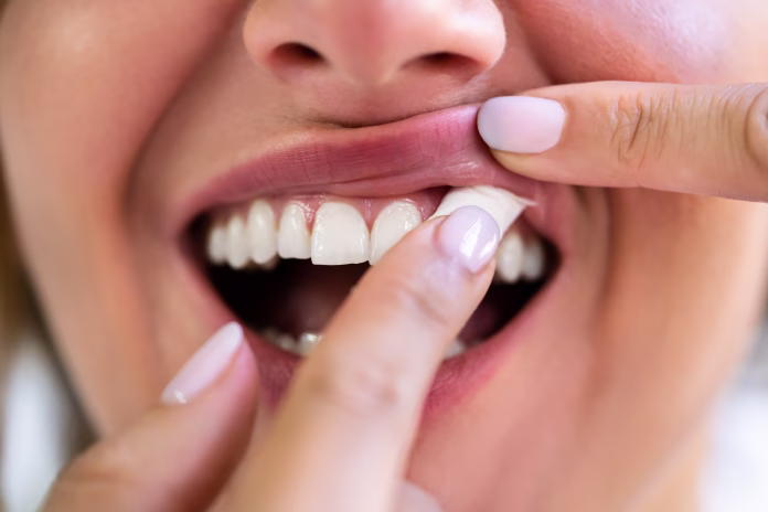 Woman Chewing Wet Moist Nicotine Tobacco Snus Product