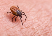 Zdravnica razkrila, kako sami odstranite klopa: brez puljenja, potrebujete le 2 stvari (VIDEO) Parasitic biting insect on background of epidermis detail. Disgusting carrier of encephalitis, Lyme disease or babesiosis infections. Tick-borne diseases