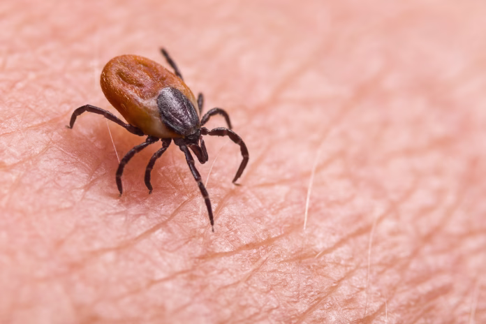 parasitic-biting-insect-on-background-of-epidermis-detail-disgusting-carrier-of-encephalitis-lyme-disease-or-babesiosis-infections-tick-borne-diseases-stockpack-istock Parasitic biting insect on background of epidermis detail. Disgusting carrier of encephalitis, Lyme disease or babesiosis infections. Tick-borne diseases