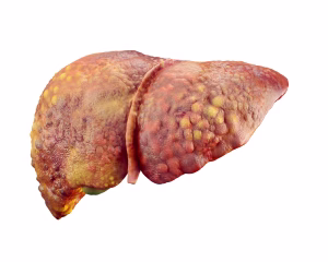 Unhealthy human liver in blank background
