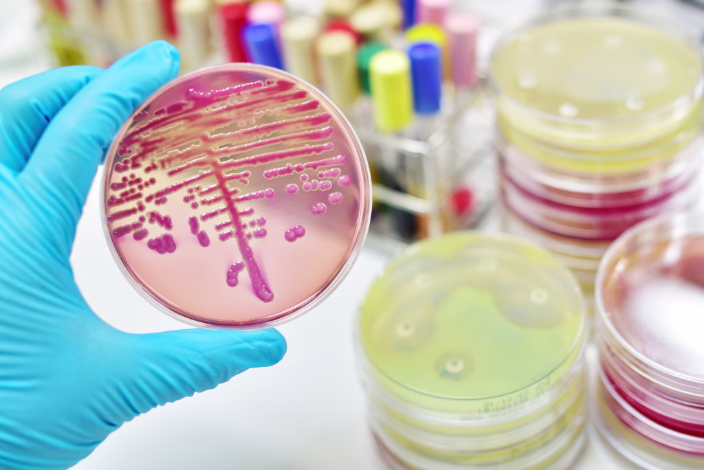 Colony of bacteria in culture medium plate