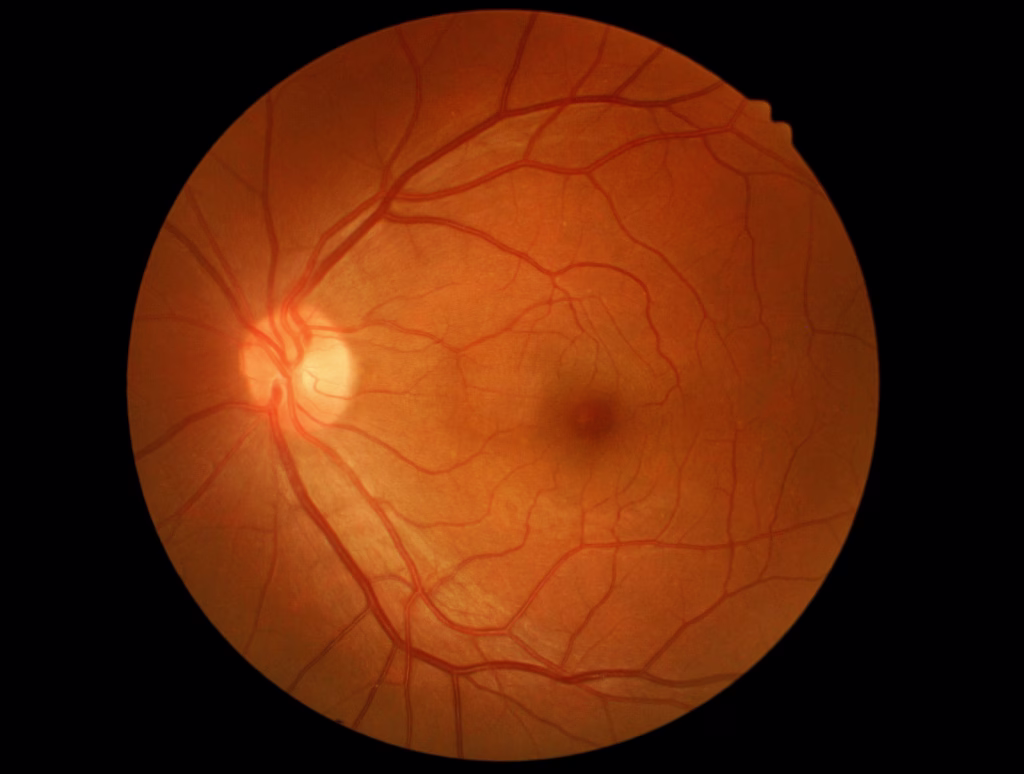 Medical Photo Retina Detail