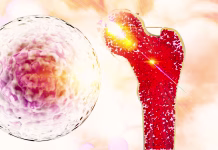 Preboj v zdravljenju raka kosti: material, ki zdravi in obnavlja Bone research concept bone cancer and stem cells treatment Osteoporosis Bone marrow bone problems diseases 3D rendering