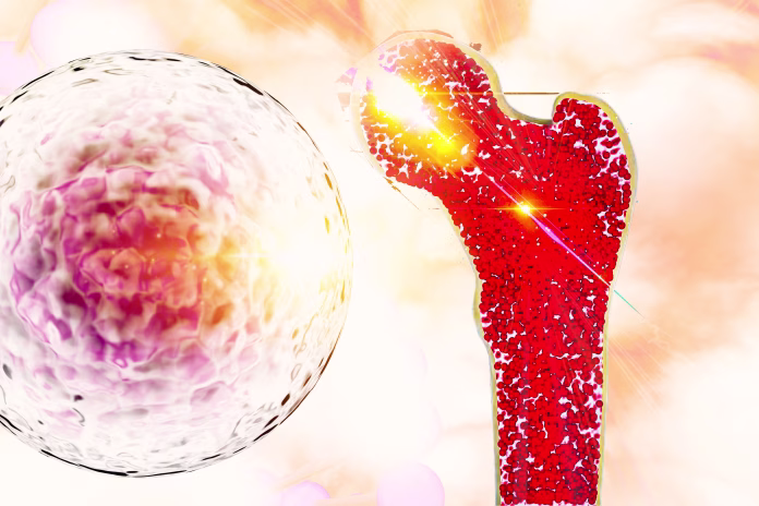 bone-research-concept-bone-cancer-and-stem-cells-treatment-osteoporosis-bone-marrow-bone-problems-diseases-3d-rendering-stockpack-istock Bone research concept bone cancer and stem cells treatment Osteoporosis Bone marrow bone problems diseases 3D rendering