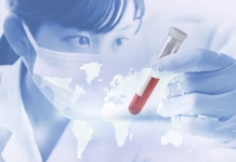 Zakaj večina medicinskih raziskav morda ne velja za polovico sveta? Medical concept image Global epidemics and treatment