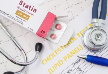 To je eno najpogosteje predpisanih zdravil na svetu: ga jemljete tudi vi? Effects and treatment of statins concept photo. Open packaging with drugs tablets, on which is written "Statin Medication", lies near stethoscope, result analysis on cholesterol (lipid panel) and ECG