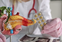 Nova možnost zdravljenja raka trebušne slinavke Doctor holds a model of the pancreas and a blister pack of medication in a clinic setting during a routine examination