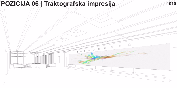 Traktografska impresija