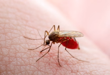 Raziskava končno razjasnila, kaj v resnici privablja komarje Dangerous Zika Infected Mosquito Skin Bite. Leishmaniasis, Encephalitis, Yellow Fever, Dengue, Malaria Disease, Mayaro or Zika Virus Infectious Culex Mosquito Parasite Insect Macro.