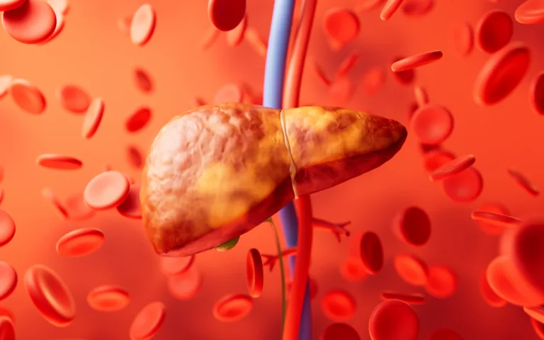 Liver organ with fatty liver state, 3d rendering. 3D illustration.
