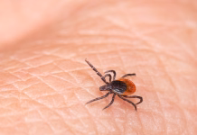 Kaj storiti, ko se klop prisesa na kožo: posujte ga s to sestavino in sam bo odpadel v 20 minutah Parasitic insect mite - bacterial or viral pathogens carrier. Lyme disease or tick-borne encephalitis transmission danger