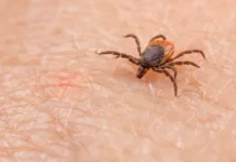 En predmet vas lahko reši pred klopi: vse, kar morate storiti, je, da ga daste v žep Closeup of insect mite on pink epidermis. Danger of tick-borne diseases transmission by infected parasite