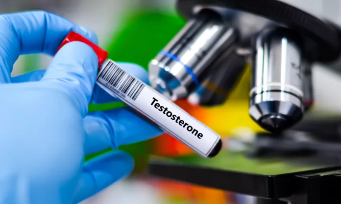 Blood sample tube for testosterone virus test analysis.