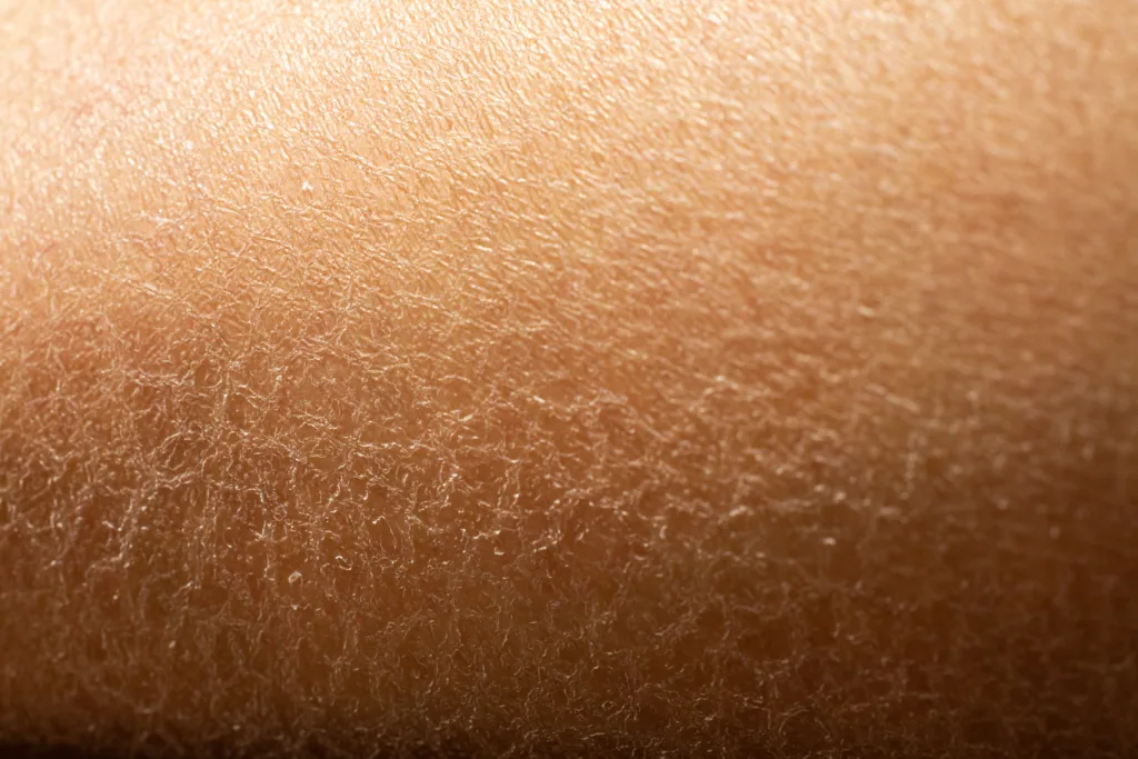 Woman's dry skin on leg, Close up & Macro shot, Asian skin tone, Abstract background