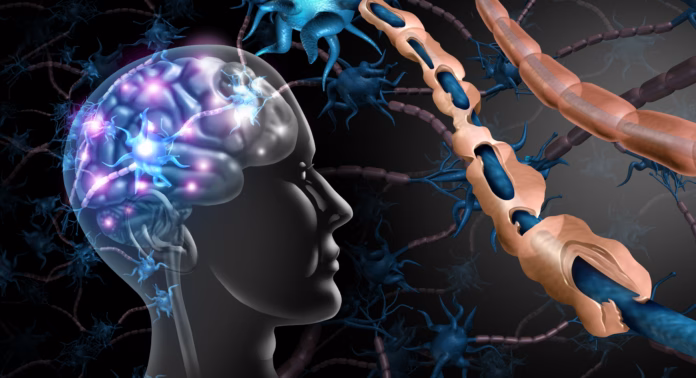 multiple-sclerosis-nerve-disorder-and-damaged-myelin-or-ms-autoimmune-disease-with-healthy-nerve-with-exposed-fibre-with-scarrred-cell-sheath-loss-with-3d-illustration-elements-stockpack-istock Multiple sclerosis nerve disorder and damaged myelin or MS autoimmune disease with healthy nerve with exposed fibre with scarrred cell sheath loss with 3D illustration elements.