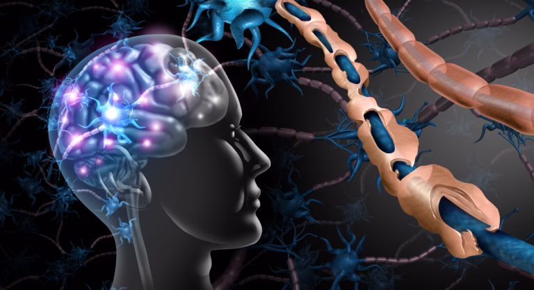 Multiple sclerosis nerve disorder and damaged myelin or MS autoimmune disease with healthy nerve with exposed fibre with scarrred cell sheath loss with 3D illustration elements.