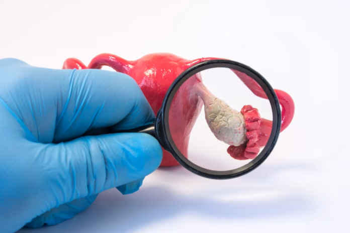 Search disease, abnormalities or pathology of ovary concept photo. Doctor holding magnifying glass and examines model of ovaries, conducting diagnostics for disease like cancer, apoplexy, cyst, POS